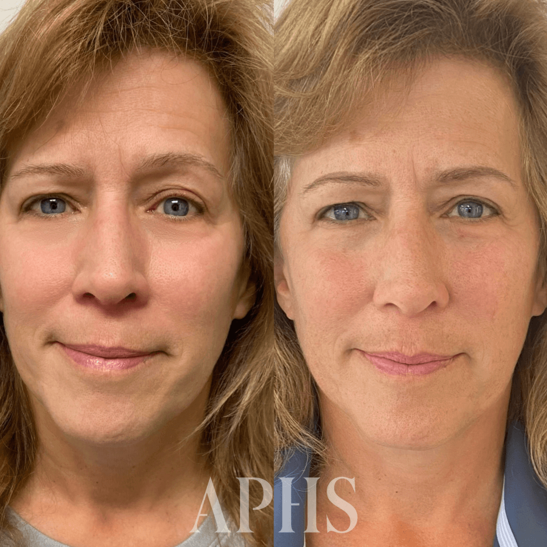 I Gave My Client More Even Brows. Here's How: