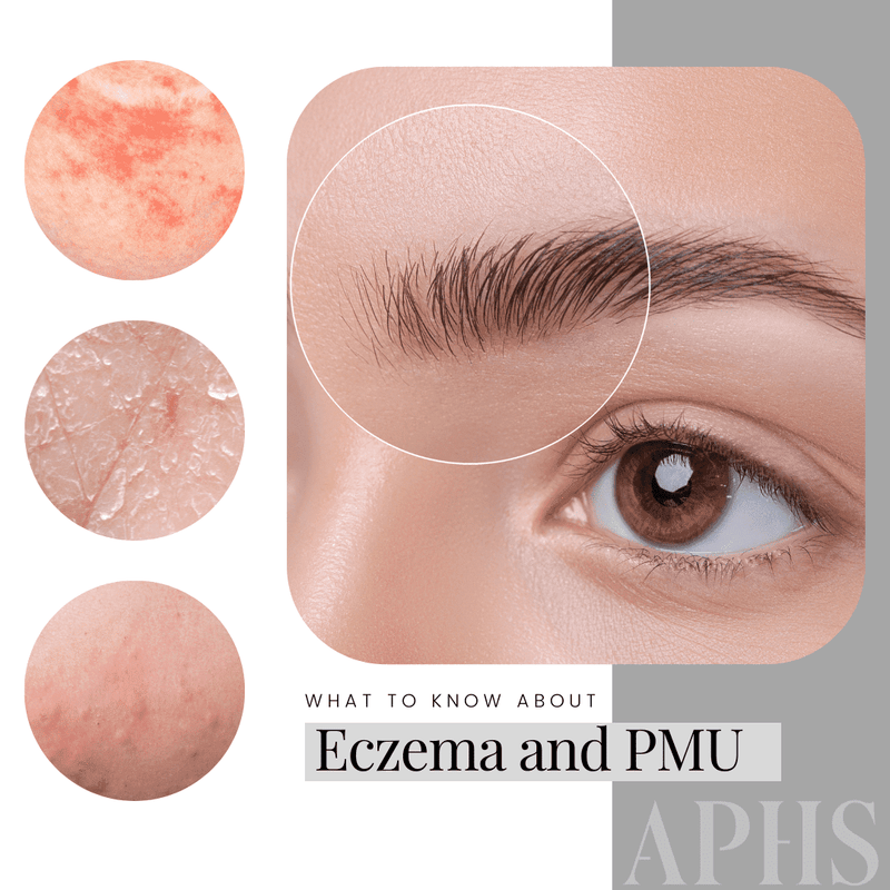 A close up of an eyebrow with three different circles that have images of possible skin concerns (eczema, rosacea, bumpy skin). They all look red and irritated. Text says "What to know about Eczema and PMU"